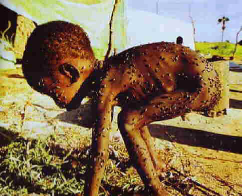 STARVING TODDLER in AFRICA, covered with FLIES.
              AMERICA, how long do you let EUROPE EXPLOIT THE DARK
              CONTINENT?